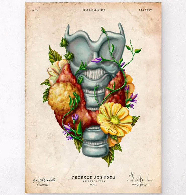 Adénome thyroïdien - Floral - Vintage-Codex Anatomicus Hot