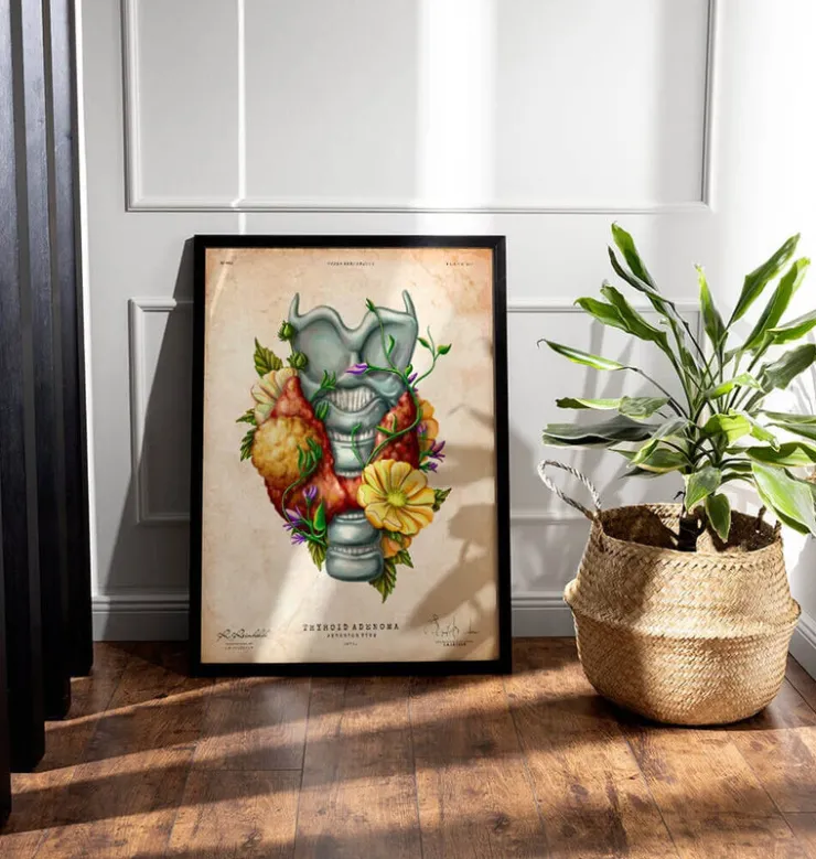 Adénome thyroïdien - Floral - Vintage-Codex Anatomicus Hot