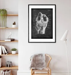 Anatomie du genou - Chalkboard-Codex Anatomicus Online