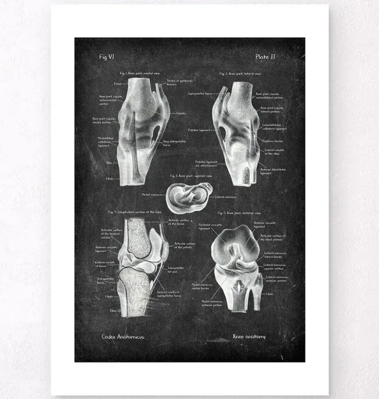 Anatomie du genou II - Chalkboard-Codex Anatomicus Clearance