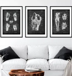Articulation du genou et muscles des jambes - Chalkboard-Codex Anatomicus Outlet
