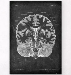 Cerveau disséqué - Chalkboard-Codex Anatomicus