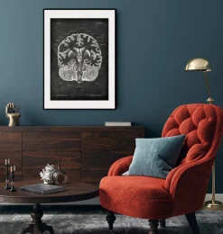 Cerveau disséqué - Chalkboard-Codex Anatomicus