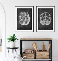 Cerveau disséqué - Chalkboard-Codex Anatomicus