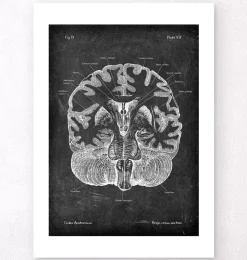 Cerveau disséqué - Chalkboard-Codex Anatomicus