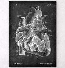Dissected heart anatomy II - Chalkboard-Codex Anatomicus Clearance