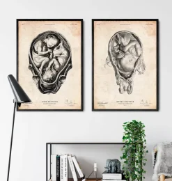 Foetus dans un utérus-Codex Anatomicus Best