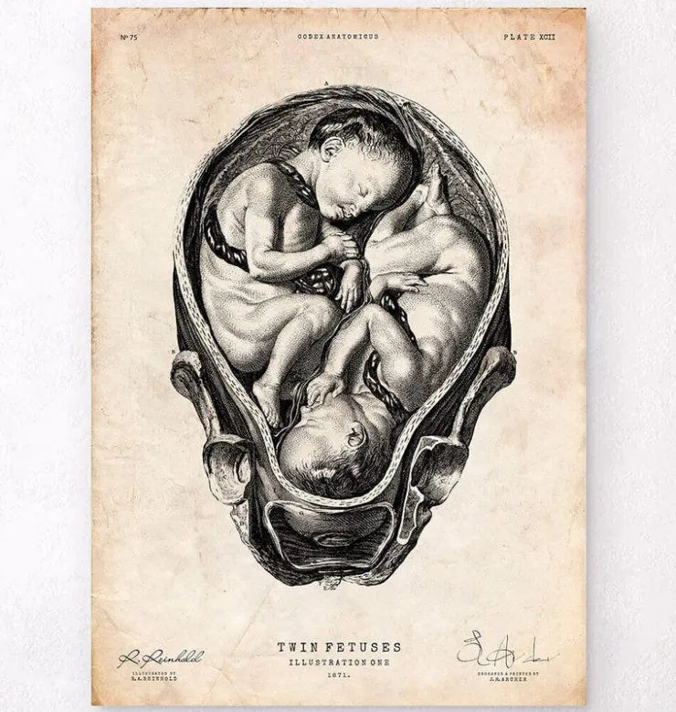 Foetus II-Codex Anatomicus Online
