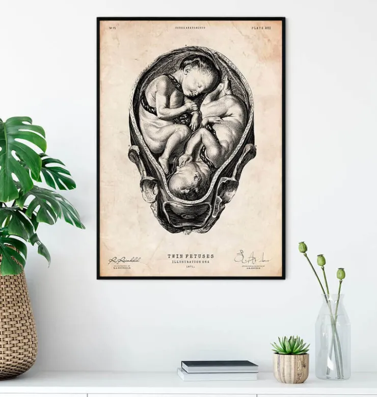 Foetus II-Codex Anatomicus Online