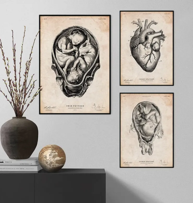 Foetus II-Codex Anatomicus Online