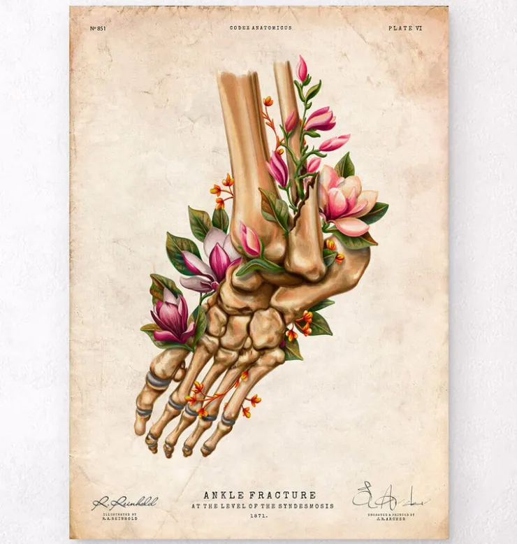 Fracture de la cheville - Floral - Vintage-Codex Anatomicus