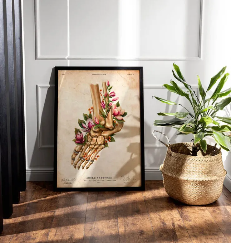 Fracture de la cheville - Floral - Vintage-Codex Anatomicus