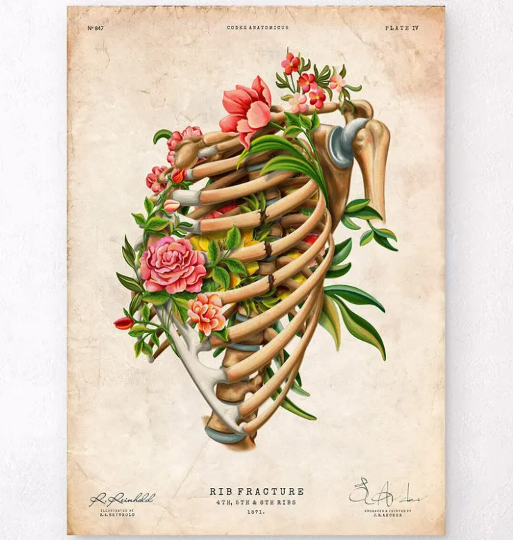 Fracture des côtes - Floral - Vintage-Codex Anatomicus Discount
