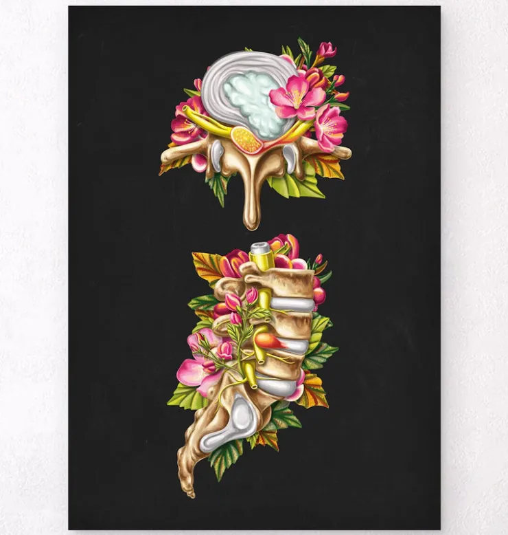Hernie discale - Floral - Noir-Codex Anatomicus Clearance
