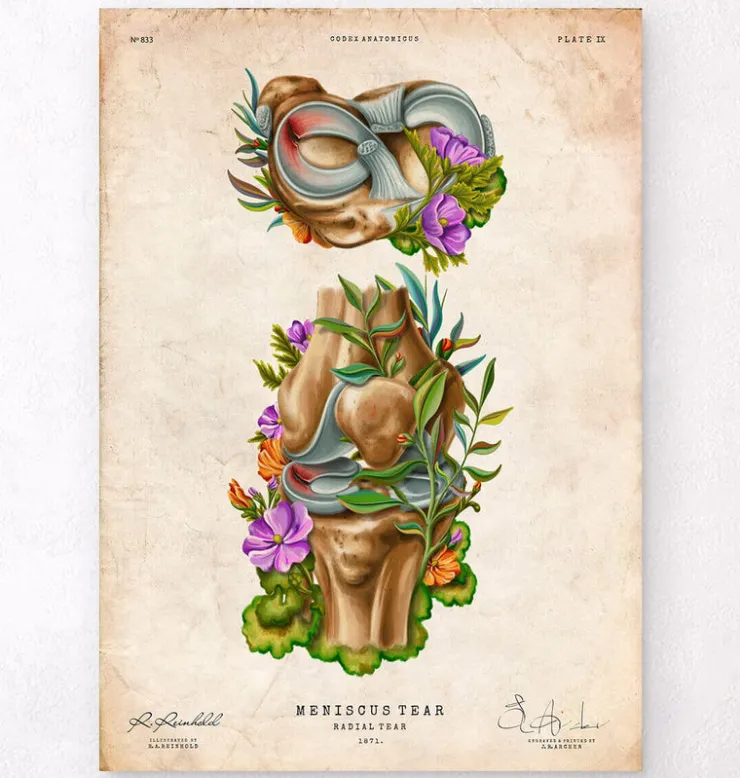 Lésion méniscale - Floral - Vintage-Codex Anatomicus Hot