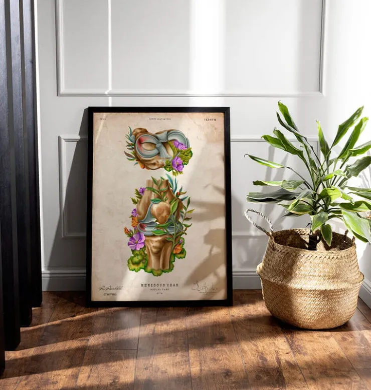 Lésion méniscale - Floral - Vintage-Codex Anatomicus Hot