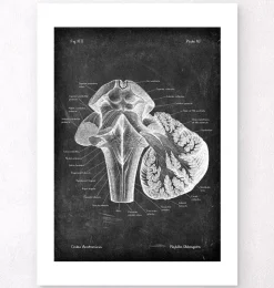 Medulla oblongata - Chalkboard-Codex Anatomicus Outlet