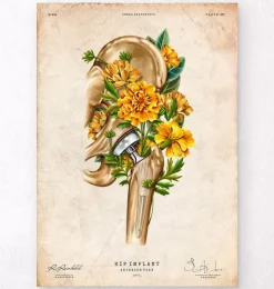 Prothèse totale de hanche - Floral - Vintage-Codex Anatomicus
