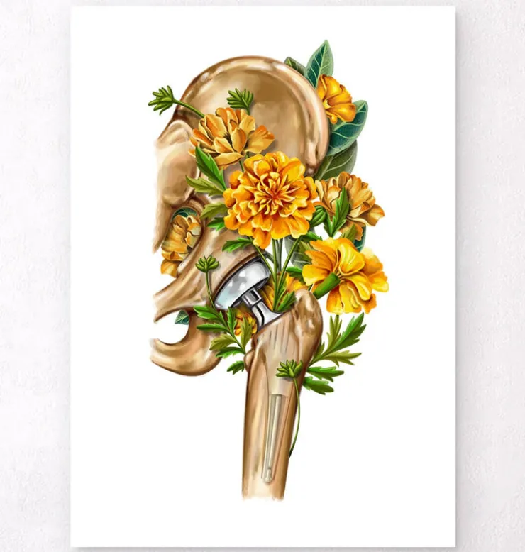 Prothèse totale de hanche - Floral - Blanc-Codex Anatomicus Discount