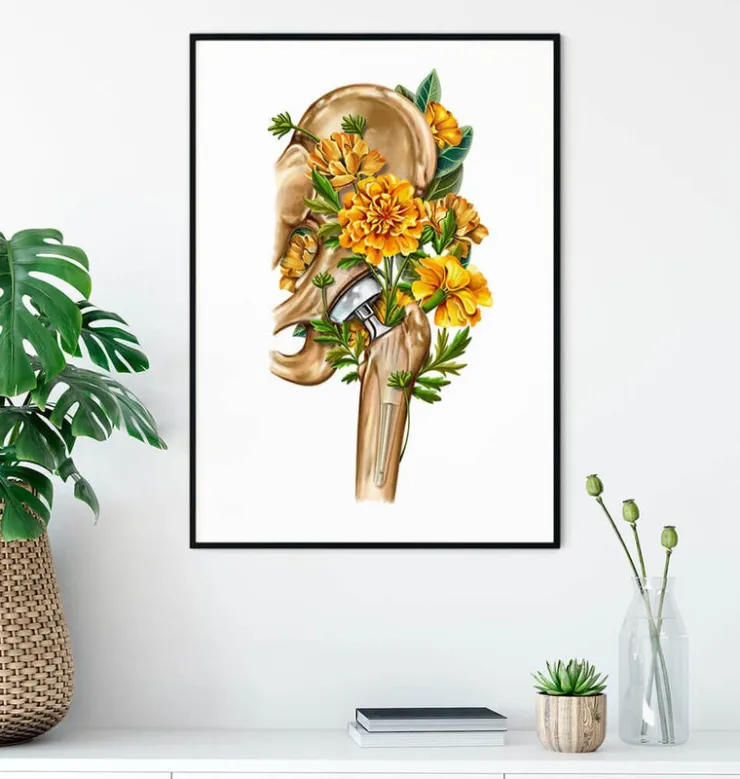 Prothèse totale de hanche - Floral - Blanc-Codex Anatomicus Discount