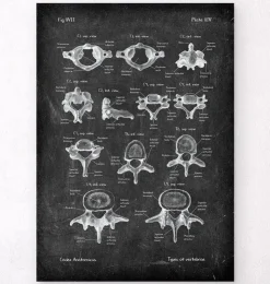 Types de vertèbres - Chalkboard-Codex Anatomicus Discount