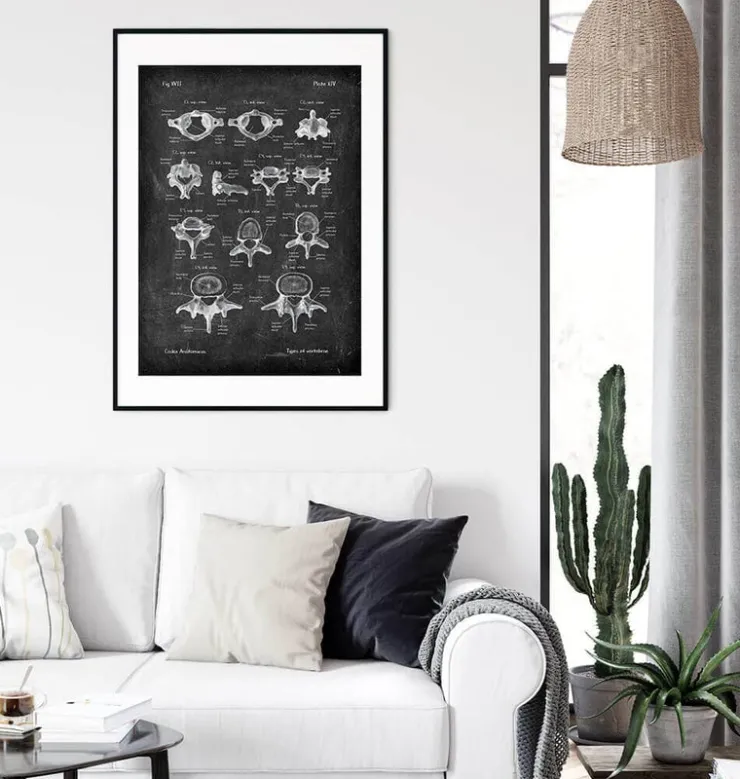 Types de vertèbres - Chalkboard-Codex Anatomicus Discount