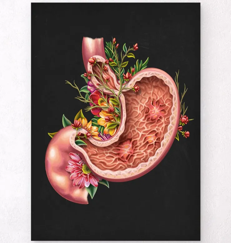 Ulcère gastrique - Floral - Noir-Codex Anatomicus Best