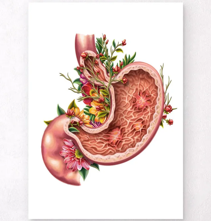 Ulcère gastrique - Floral - Blanc-Codex Anatomicus Online