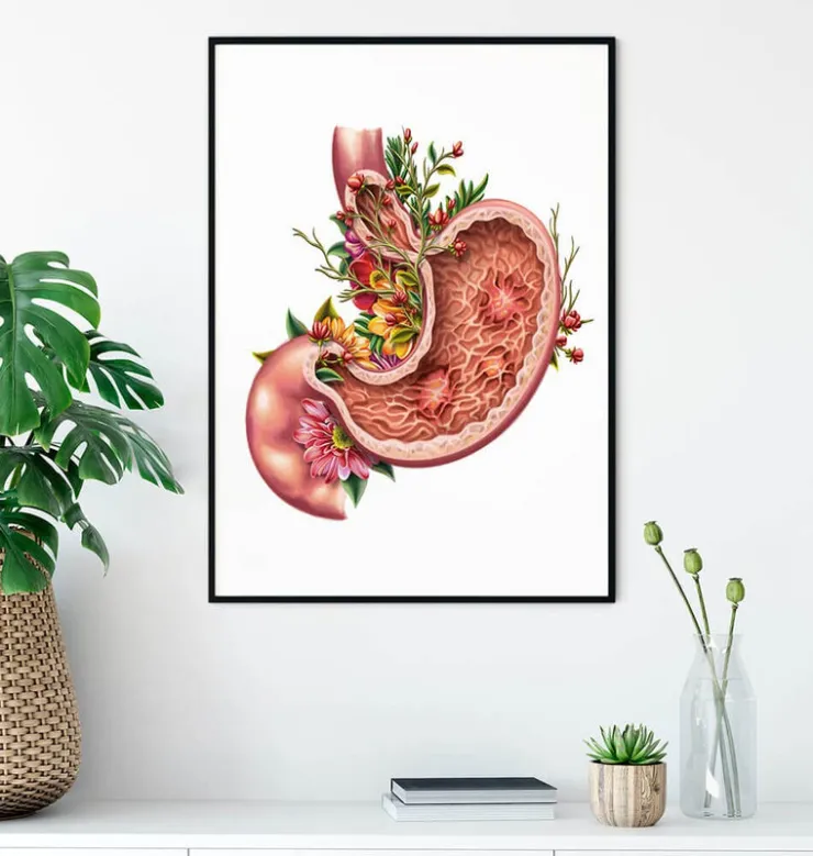 Ulcère gastrique - Floral - Blanc-Codex Anatomicus Online